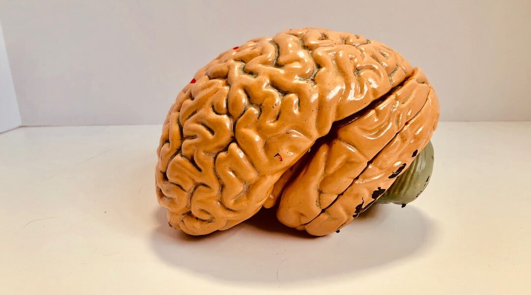 Photo Brain scan